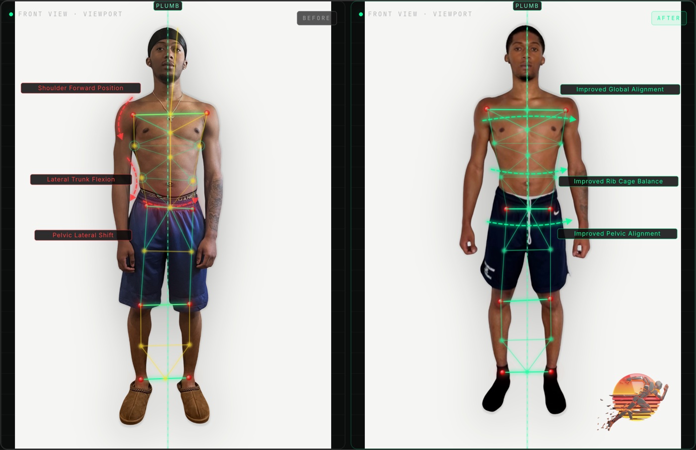 Amari H. front view posture before and after