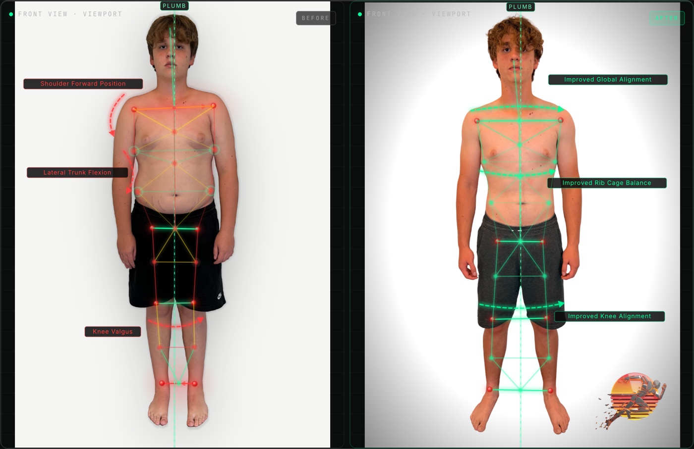 Ben S. front view posture before and after