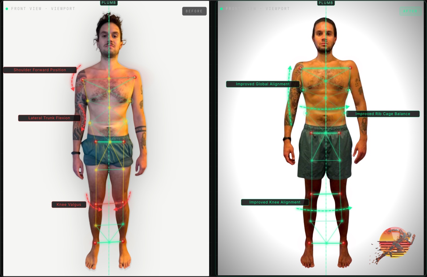 Ben T. front view posture before and after