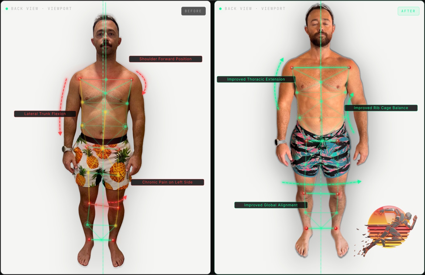 Justin K. front view posture before and after