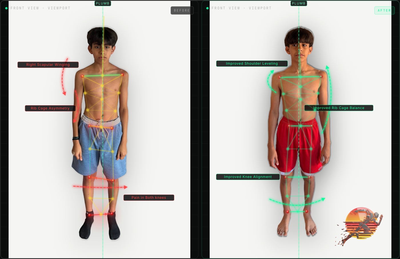 Paolo O. front view posture before and after