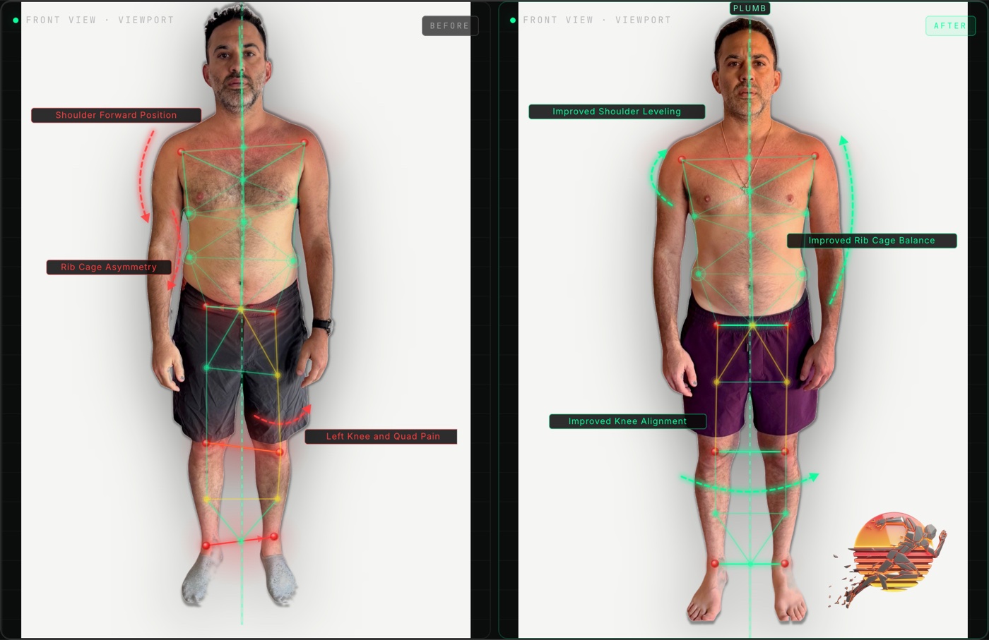 Sam A. front view posture before and after
