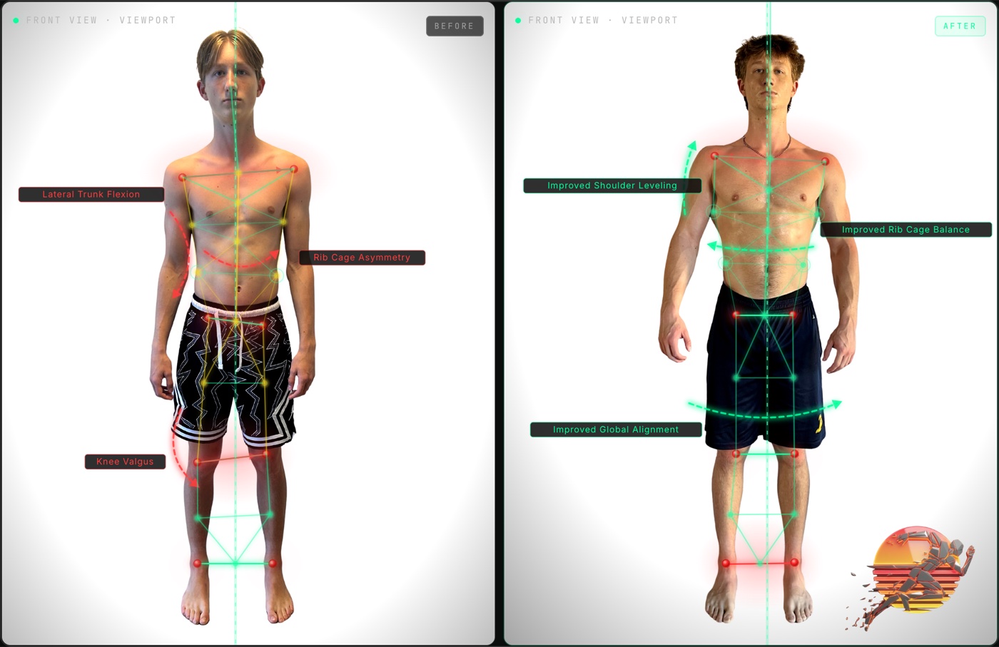 Sam S. front view posture before and after